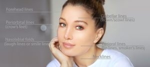 Dermal fillers in Mt. Vernon, WA